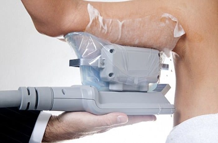 fat freezing arms Avonmouth