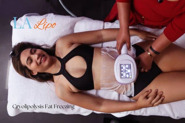 woman getting cryolipolysis Avonmouth