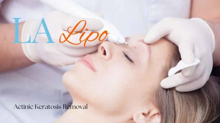 Woman receiving Actinic Keratosis Removal Treatment Avonmouth