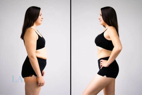 LA-EMS Body Sculpting Avonmouth results before and after of womans results on body toning.