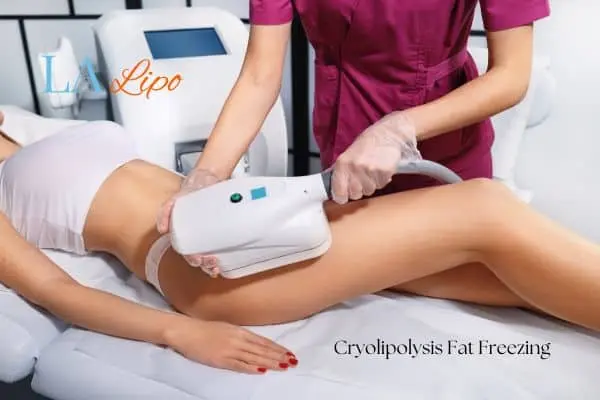Woman receiving coolsculpting Avonmouth treatment on her thighs