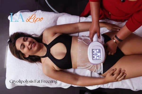 woman getting cryolipolysis Avonmouth