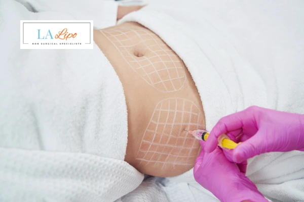 aqualyx fat dissolving injections Avonmouth