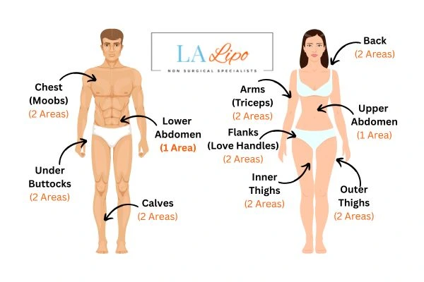 LA LIPO Cryolipolysis Areas Avonmouth