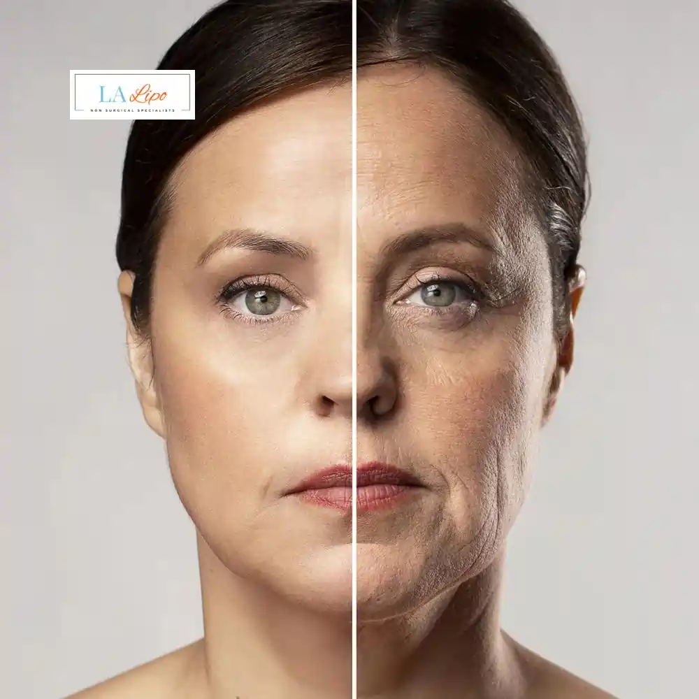 How Can You Tell If Non-Surgical Skin Tightening Is Right for You Avonmouth?