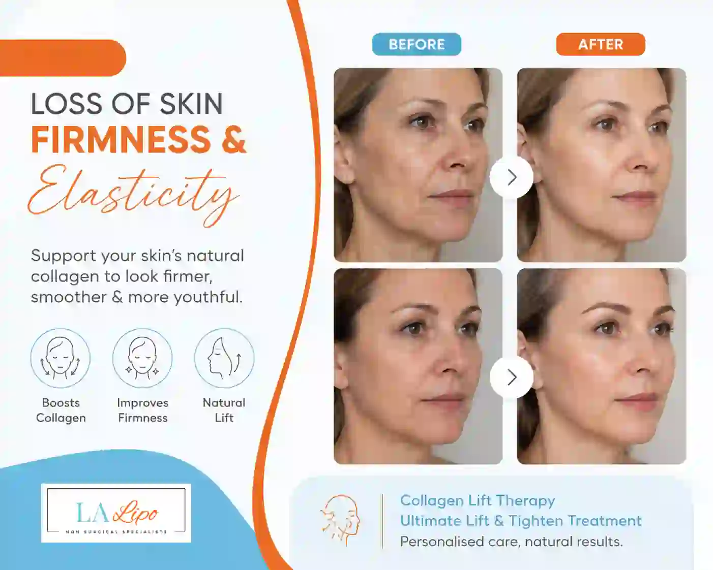 Sign #7: Loss of Skin Firmness and Elasticity Avonmouth