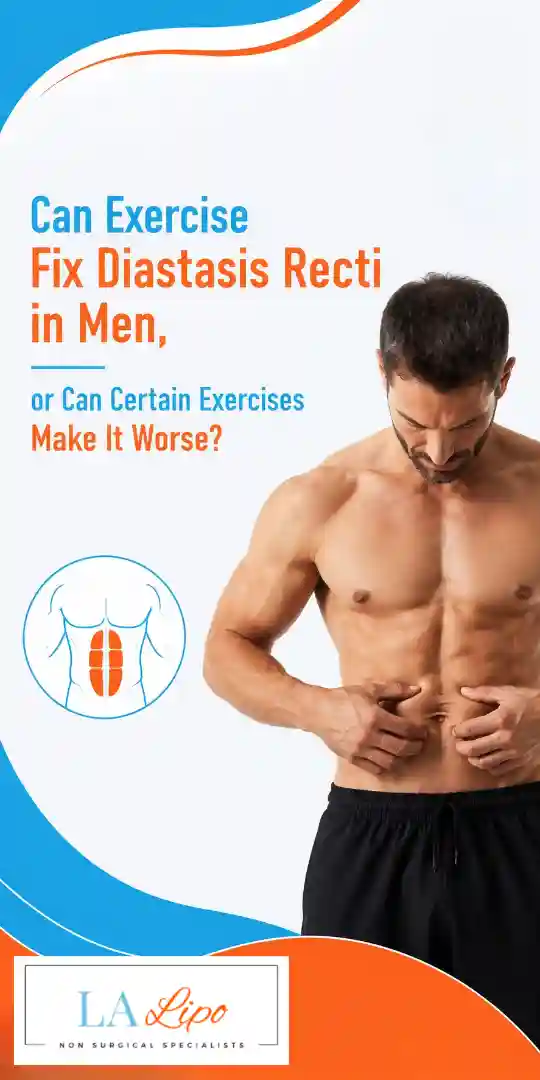 Can Exercise Fix Diastasis Recti in Men, or Can Certain Exercises Make It Worse Avonmouth?