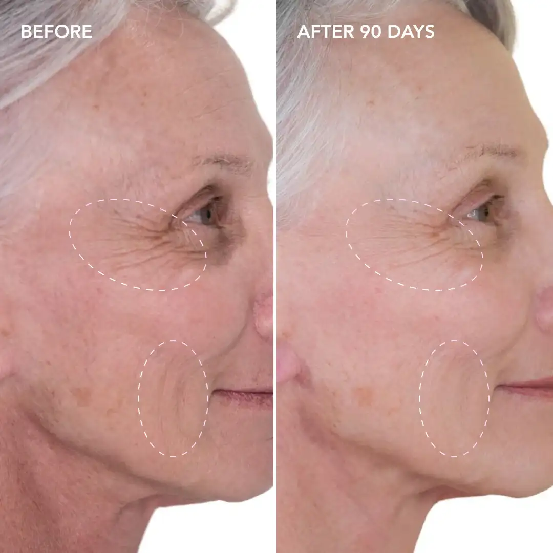 When will you see results Avonmouth